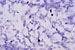 JR01251 esporulação em Bacillus subtilis: endosporos, técnica de Moller, 500x 